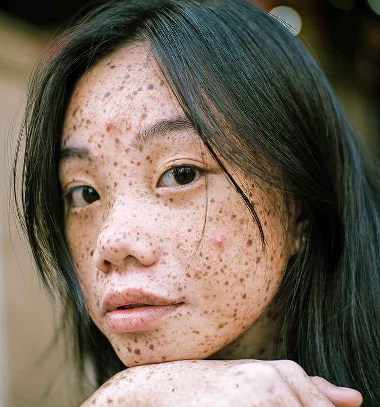 skin